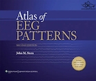 Atlas of EEG Patterns | اطلس الگوهای EEG